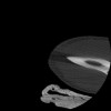 SPORK, NICO - 22.03.1976 - 02.08.2022 - CT obere Extremität - 17:51:17